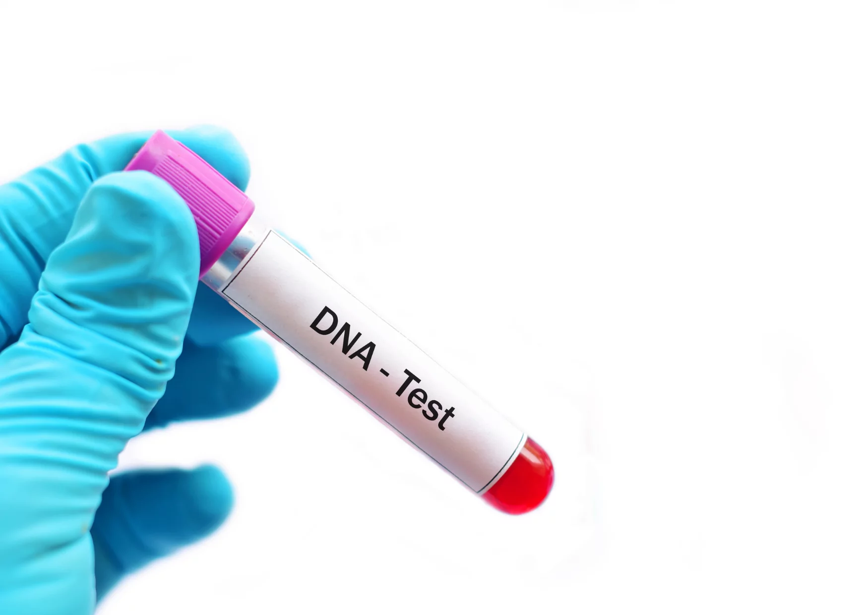 Pretoria DNA Tests Increasing in Popularity